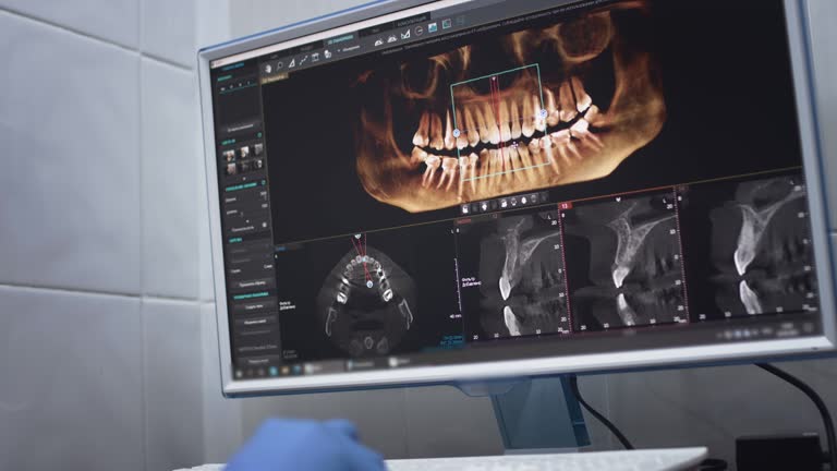 Full Mouth Reconstruction in Beaver Falls, PA